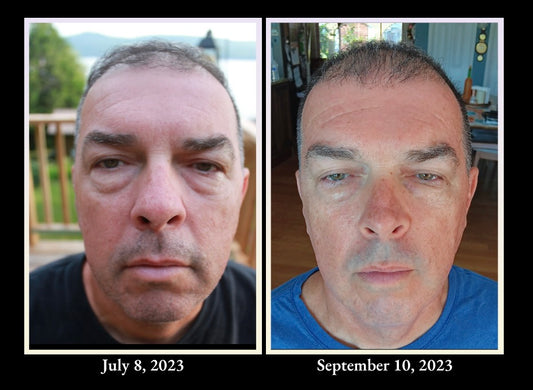 Frankincense Eye Serum - Night Repair